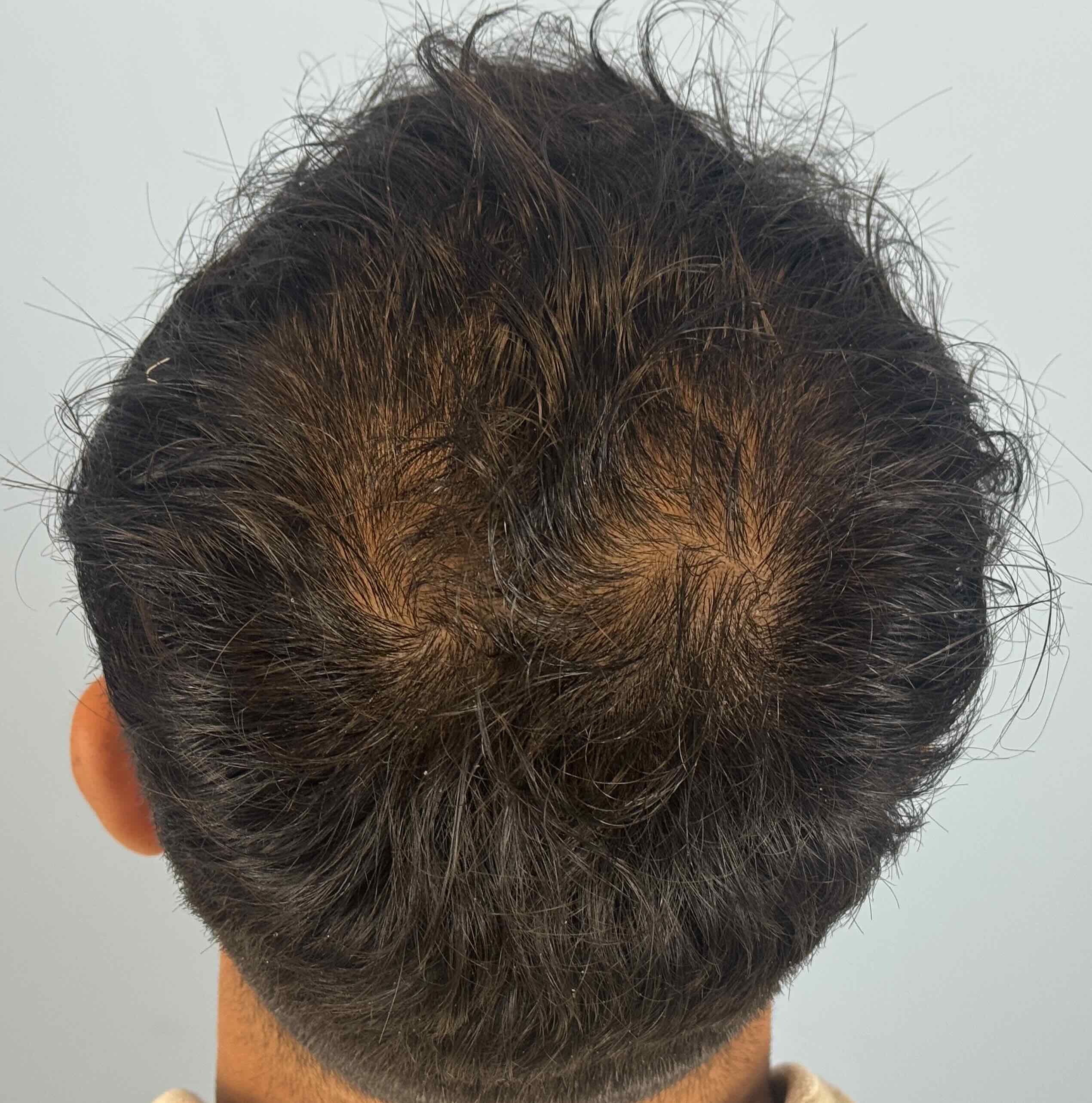 back before